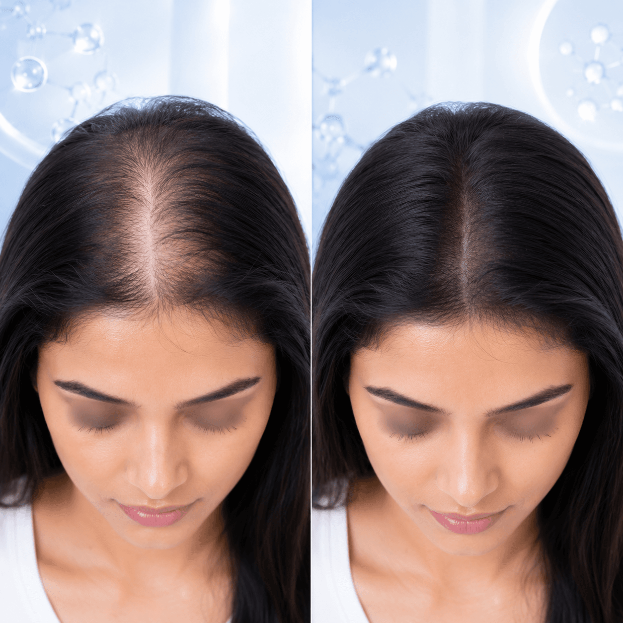PRP hair treatment result showcase