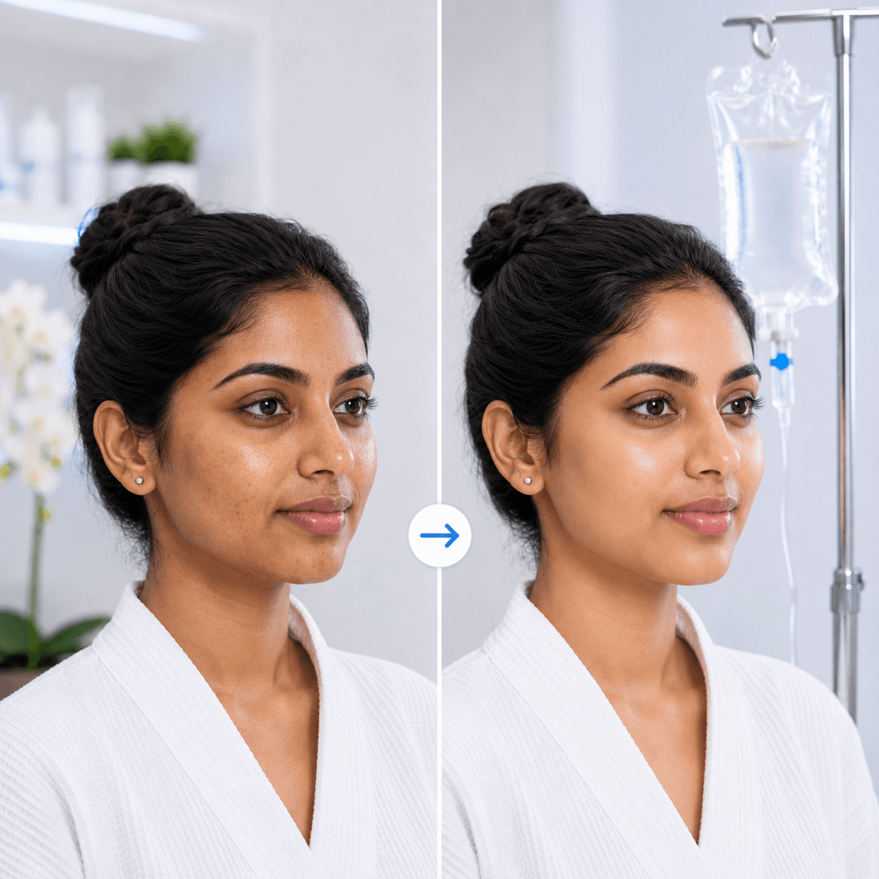 Glutathione IV before and after result 1