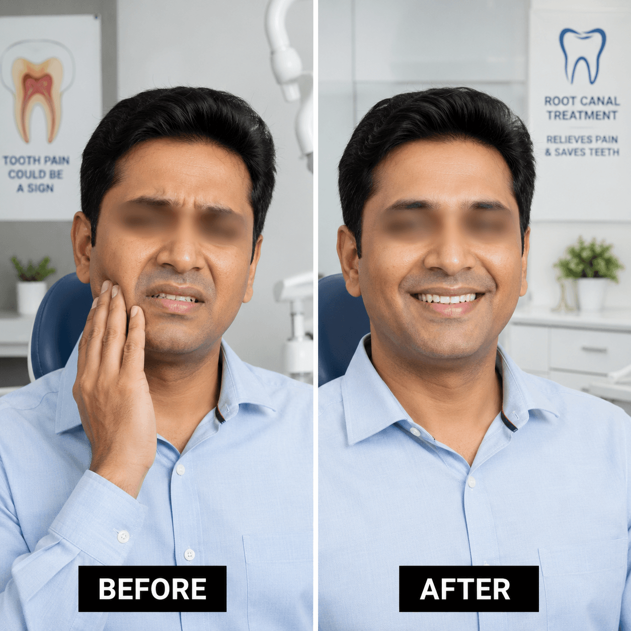 Root canal treatment result showcase
