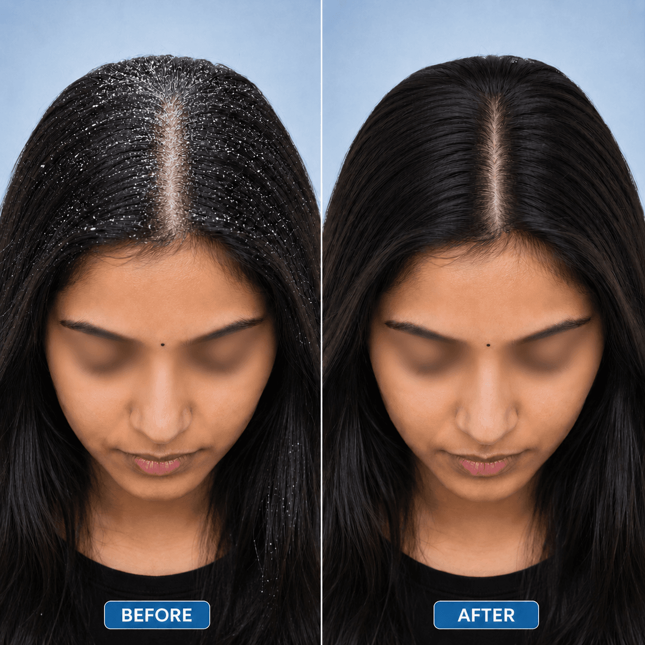 Dandruff treatment result showcase