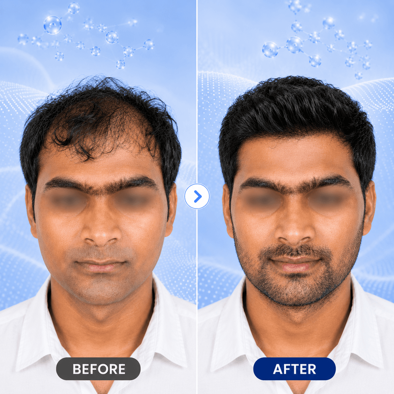 GFC hair restoration visual