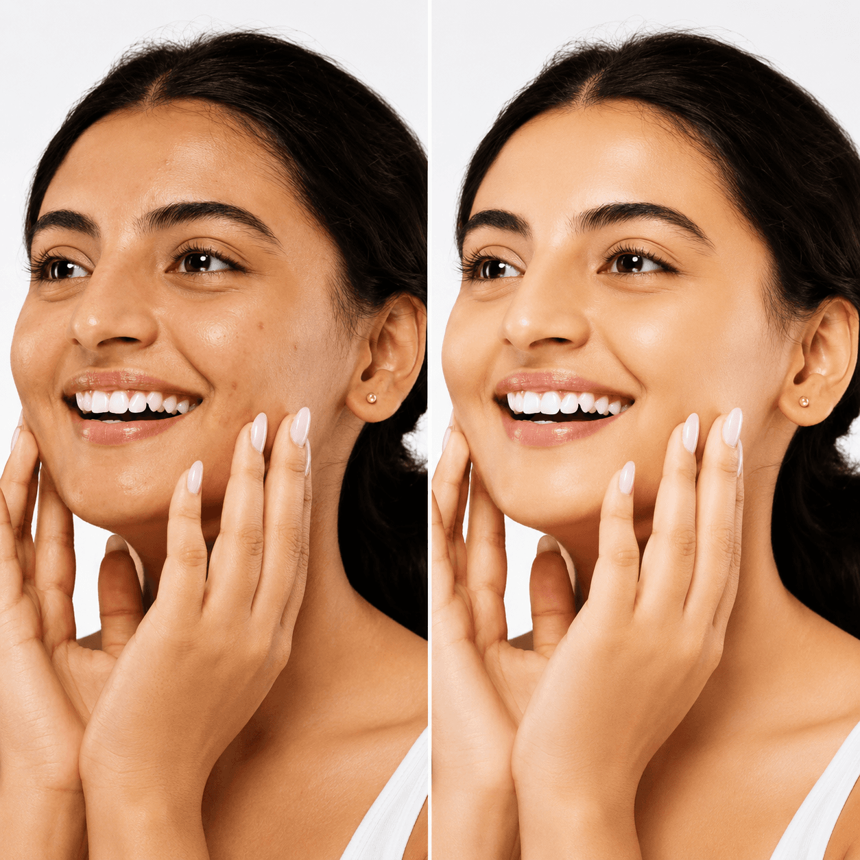 Glutathione IV before and after result 3